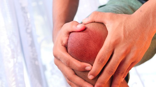 What Is Bursitis