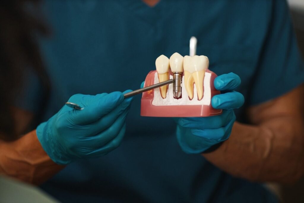 Comparing Implants to Other Tooth Replacement Options