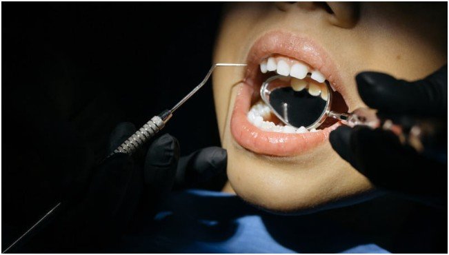 Understanding Dental Trauma in Young Patients